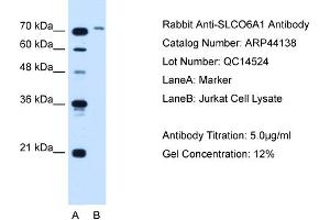 WB Suggested Anti-SLCO6A1  Antibody Titration: 5. (SLCO6A1 anticorps  (N-Term))