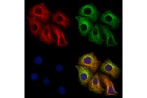 ABIN6265121 and ABIN6273320 staining Hela cells by IF/ICC. (SLC25A46 anticorps  (N-Term))