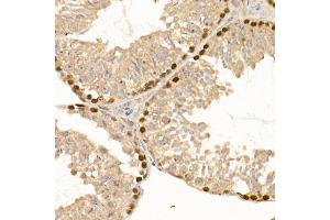 Immunohistochemistry of paraffin-embedded mouse testis using [KO Validated] DNMT1 Rabbit mAb (ABIN7266808) at dilution of 1:100 (40x lens).
