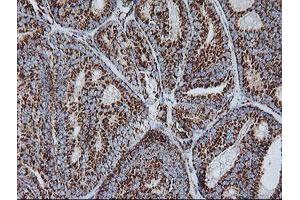 Image no. 5 for anti-NADH Dehydrogenase (Ubiquinone) 1 beta Subcomplex, 10, 22kDa (NDUFB10) antibody (ABIN1499669)