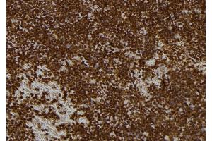 ABIN6273521 at 1/100 staining Mouse spleen tissue by IHC-P. (PMS1 anticorps  (Internal Region))