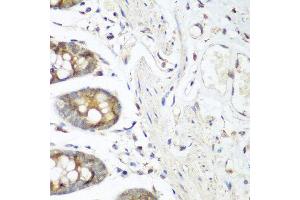 Immunohistochemistry of paraffin-embedded human colon using FLT4 antibody at dilution of 1:200 (40x lens). (FLT4 anticorps)