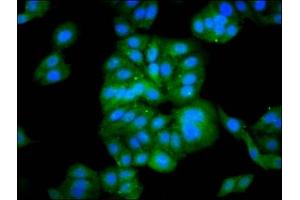 Immunofluorescence staining of HepG2 cells with ABIN7165258 at 1:133, counter-stained with DAPI. (DEPP1 (AA 57-174) anticorps)