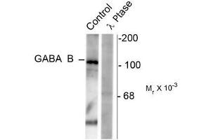 Image no. 1 for anti-gamma-aminobutyric Acid (GABA) B Receptor, 1 (GABBR1) (pSer923) antibody (ABIN372645) (GABBR1 anticorps  (pSer923))