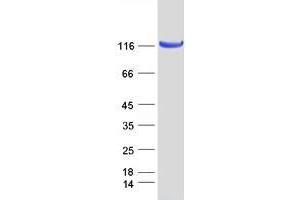 Validation with Western Blot