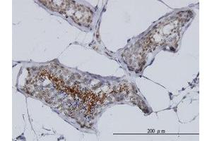 Image no. 1 for anti-A Kinase (PRKA) Anchor Protein 4 (AKAP4) (AA 1-101) antibody (ABIN599074) (AKAP4 anticorps  (AA 1-101))