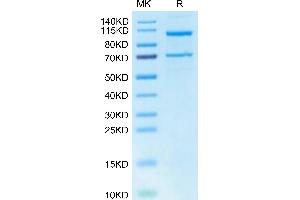Human Complement C5 on Tris-Bis PAGE under reduced condition.