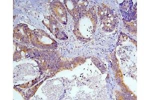 IHC analysis of Caspase-3 using anti-Caspase-3 antibody (ABIN6719555). (Caspase 3 anticorps  (AA 67-175))