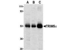 Western blot analysis of TRIM5 alpha expression in human stomach (A), thymus (B), and uterus (C) cell lysate with this product at 2 μg /ml. (TRIM5 anticorps  (C-Term, Isoform alpha))