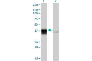 Western Blot analysis of TRDD3 expression in transfected 293T cell line by TRDD3 MaxPab polyclonal antibody. (TRDD3 anticorps  (AA 1-296))