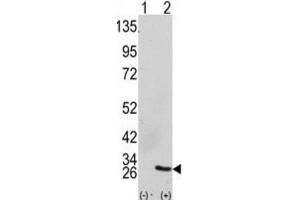 Western Blotting (WB) image for anti-Growth Factor Receptor-Bound Protein 2 (GRB2) antibody (ABIN3002593) (GRB2 anticorps)