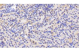 Detection of AGXT2 in Human Kidney Tissue using Polyclonal Antibody to Alanine Glyoxylate Aminotransferase 2 (AGXT2)