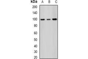 Western blot analysis of SAP145 expression in Hela (A), MCF7 (B), mouse testis (C) whole cell lysates. (SF3B2 anticorps)