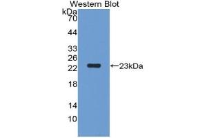 Detection of Recombinant PGLYRP1, Rat using Polyclonal Antibody to Peptidoglycan Recognition Protein 1 (PGLYRP1) (PGLYRP1 anticorps  (AA 18-183))