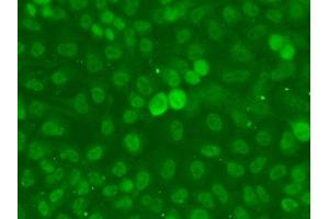 Immunofluorescence analysis of A549 cell using SSNA1 antibody. (SSNA1 anticorps)