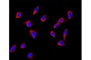 Immunofluorescence analysis of SOX9 antibody and HeLa cells.