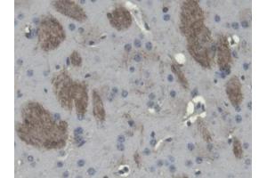 DAB staining on IHC-P; Samples: Mouse Cerebrum Tissue