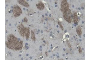 DAB staining on IHC-P; Samples: Mouse Cerebrum Tissue (Cnpase anticorps  (AA 110-365))