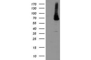 Western Blotting (WB) image for anti-Phosphoglucomutase 3 (PGM3) antibody (ABIN1500177)