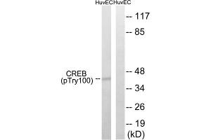 Western blot analysis of extracts from HUVEC cells, treated with etoposide (25uM, 24hours), using CREB (Phospho-Thr100) antibody. (CREB1 anticorps  (pThr100))