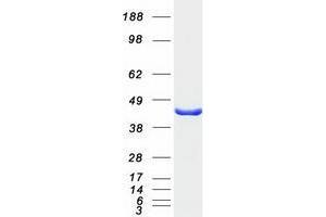 Validation with Western Blot