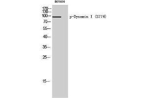 Western Blotting (WB) image for anti-Dynamin 1 (DNM1) (pSer774) antibody (ABIN3182513) (Dynamin 1 anticorps  (pSer774))