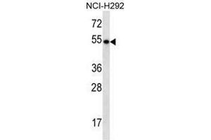TBC1D3E Antibody (C-term) western blot analysis in NCI-H292 cell line lysates (35µg/lane). (TBC1D3E (AA 497-527), (C-Term) anticorps)