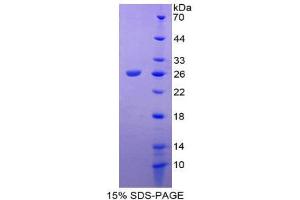 SDS-PAGE (SDS) image for Tachykinin Receptor 2 (TACR2) (AA 1-200) protein (His tag) (ABIN2126910)