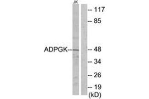 Western blot analysis of extracts from Jurkat cells, using ADPGK Antibody. (ADPGK anticorps  (AA 241-290))