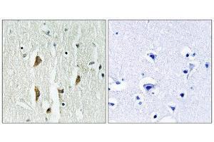 Immunohistochemistry (IHC) image for anti-P21-Activated Kinases 1/2/3 (PAK1/2/3) (Thr402), (Thr421), (Thr423) antibody (ABIN1847964)
