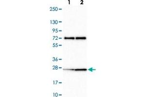 Western blot analysis of Lane 1: Human cell line RT-4 Lane 2: Human cell line U-251MG sp with CLK2 polyclonal antibody  at 1:100-1:250 dilution.