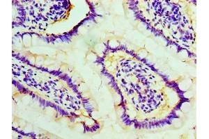 Immunohistochemistry of paraffin-embedded human small intestine tissue using ABIN7170819 at dilution of 1:100 (STIP1 anticorps  (AA 1-543))