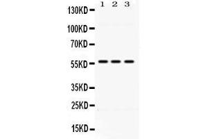 Western blot analysis of ALDH1B1 expression in rat liver extract ( Lane 1), mouse liver extract ( Lane 2) and HELA whole cell lysates ( Lane 3). (ALDH1B1 anticorps  (N-Term))