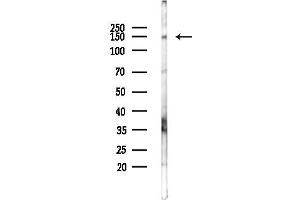 Western blot analysis of lysates from F10-LUC cells(starvation 24h treatment), using ATXN2 Antibody at 1/1000 dilution.