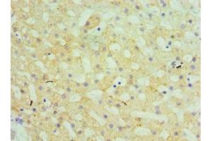 Immunohistochemistry of paraffin-embedded human liver tissue using ABIN7154176 at dilution of 1:100 (GATM anticorps  (AA 124-423))