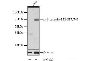 Western blot analysis of extracts of 293T cells using Phospho-β-catenin(S33/S37/T41) Polyclonal Antibody.