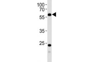 Western blot analysis of lysate from human kidney tissue using PFKFB3 antibody at 1:1000.