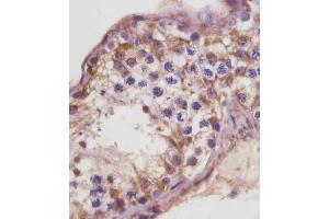 (ABIN6243319 and ABIN6578857) staining TGFBR3 in human testis tissue sections by Immunohistochemistry (IHC-P - paraformaldehyde-fixed, paraffin-embedded sections).