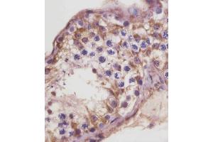 (ABIN6243319 and ABIN6578857) staining TGFBR3 in human testis tissue sections by Immunohistochemistry (IHC-P - paraformaldehyde-fixed, paraffin-embedded sections). (TGFBR3 anticorps  (AA 285-319))