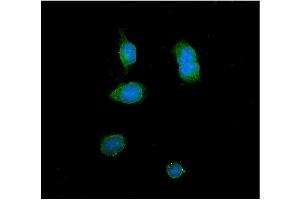 IF analysis of ITLN1 using anti-ITLN1 antibody (ABIN4886644). (ITLN1/Omentin anticorps  (N-Term))