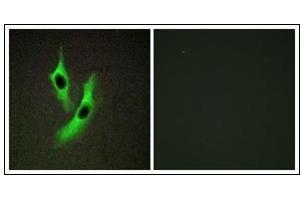 Immunofluorescence analysis of HeLa cells, using STEAP4 Antibody. (STEAP4 anticorps)