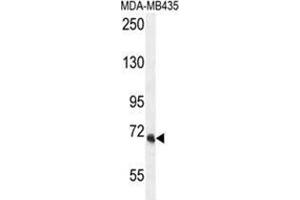 VPS52 Antibody (C-term) western blot analysis in MDA-MB435 cell line lysates (35 µg/lane).