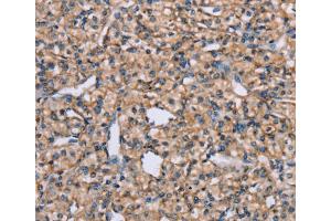 Immunohistochemistry (IHC) image for anti-ADAM Metallopeptidase Domain 29 (ADAM29) antibody (ABIN2427053) (ADAM29 anticorps)