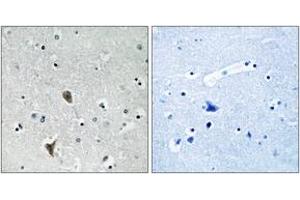Immunohistochemistry analysis of paraffin-embedded human brain tissue, using OXR1 Antibody. (OXR1 anticorps  (AA 472-521))