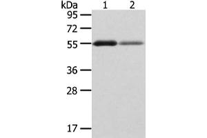 Gel: 8 % SDS-PAGE, Lysate: 40 μg, Lane 1-2: Human thyroid cancer and normal stomach tissue, Primary antibody: ABIN7193074(XKR3 Antibody) at dilution 1/200 dilution, Secondary antibody: Goat anti rabbit IgG at 1/8000 dilution, Exposure time: 2 minutes
