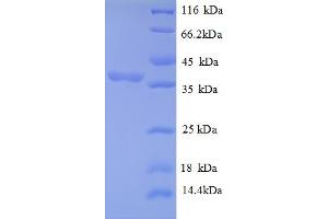SDS-PAGE (SDS) image for Ribosomal Protein, Large, P2 (RPLP2) (AA 1-113), (partial) protein (GST tag) (ABIN5712217) (RPLP2 Protein (AA 1-113, partial) (GST tag))