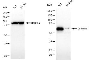 Western blotting analysis using catalase antibody (ABIN7797921). (Recombinant Catalase anticorps)