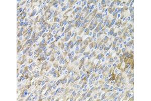 Immunohistochemistry of paraffin-embedded Mouse stomach using MBL2 Polyclonal Antibody (MBL2 anticorps)