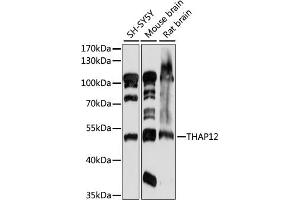 Western blot analysis of extracts of various cell lines, using TH antibody (ABIN7269714) at 1:1000 dilution. (PRKRIR anticorps  (AA 1-300))