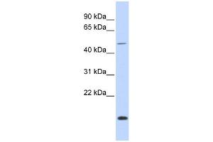 WB Suggested Anti-FOXN3 Antibody Titration:  0. (FOXN3 anticorps  (Middle Region))